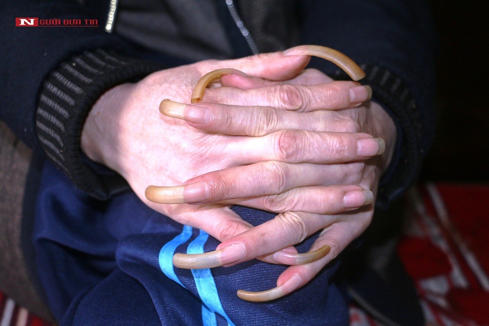 Do bị "biệt giam" 3 năm nên khi được giải cứu, trả tự do móng tay của ông Năm đã rất dài.