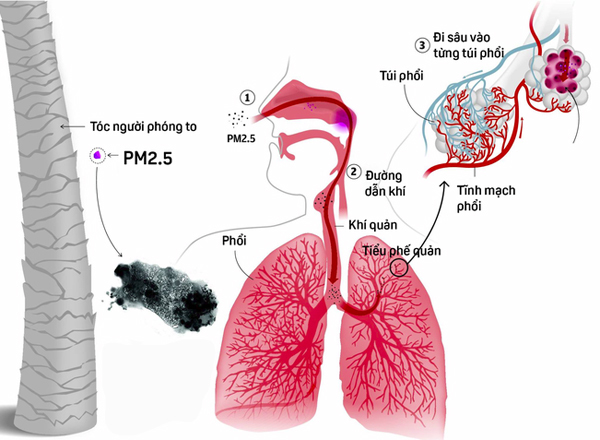Bụi PM2.5 có thể xâm nhập sâu vào cơ thể