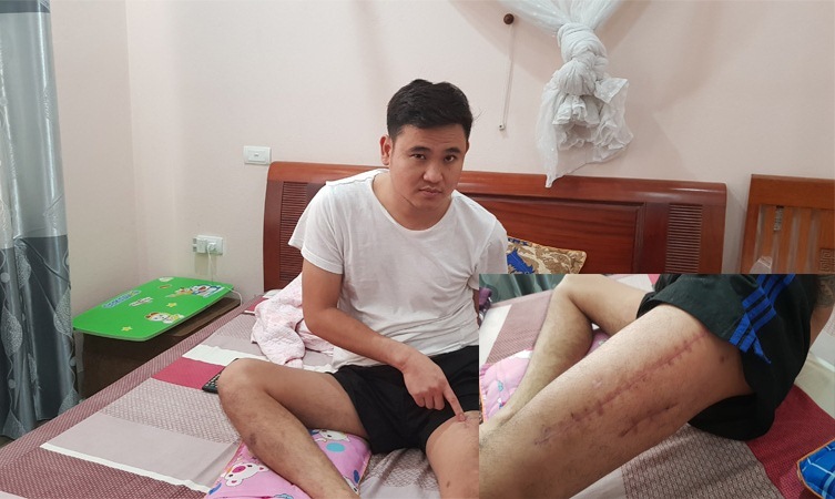 Anh Cường sau khi được mổ để ghép xương
