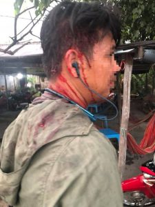 Chồng chị Duyên bị đánh chảy máu đầu.