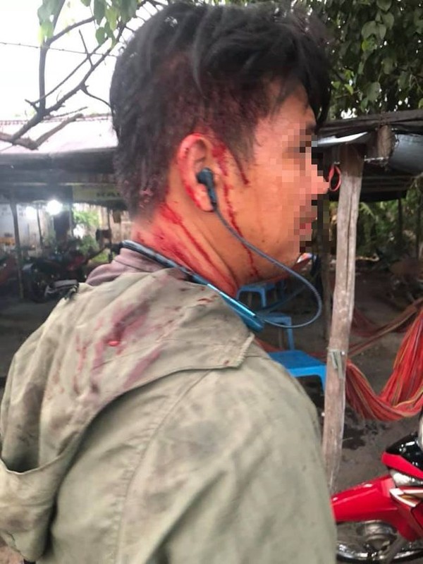 Chồng chị Duyên bị đánh chảy máu đầu.